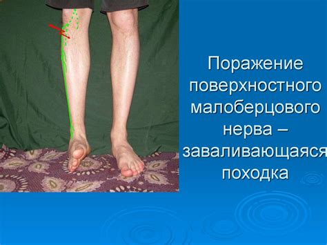 Хирургическая анатомия и операции на нервах и сухожилиях - online ...