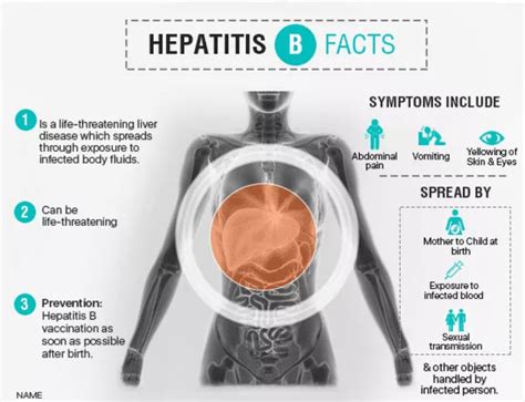 Hepatitis Symptoms