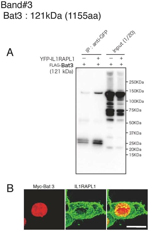 Analysis Of Il Rapl Binding Protein Candidates Band A