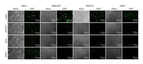 Gfp Gene Expression By Different Cell Types Transduced With