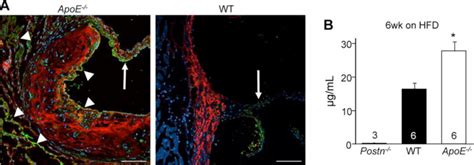 Figure 11 From Dissecting The Roles Of Periostin And TGFBI In