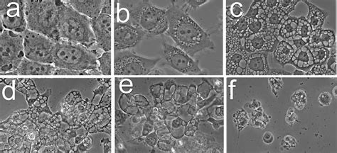 Apoptosis Paraptosis And Autophagy Death And Survival Pathways