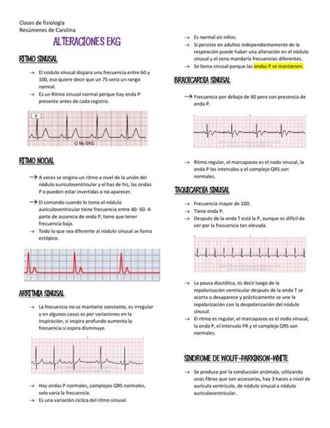 Alteraciones Del Ekg Carolina Coronado Vargas Udocz