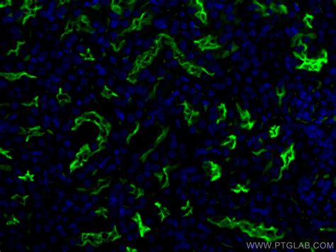 CD133 Fusion Protein Ag29051 Proteintech 武汉三鹰生物技术有限公司