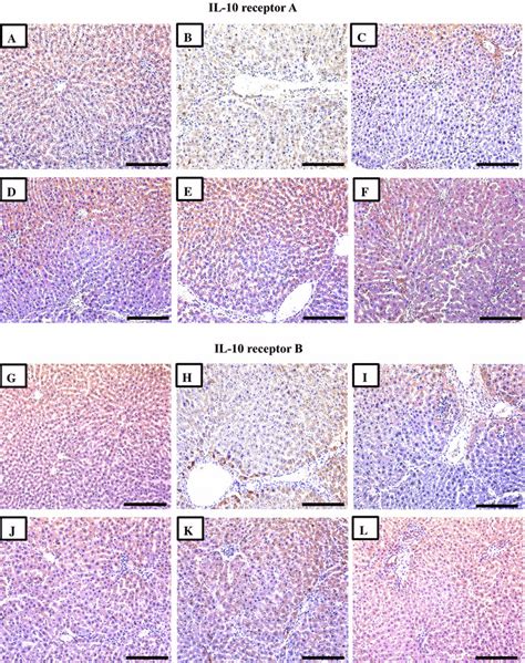 Immunohistochemical Expression Of IL 10 Receptors A And B In Liver