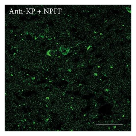 Double Labeling Immunofluorescence Demonstrating Colocalization Of Download Scientific Diagram