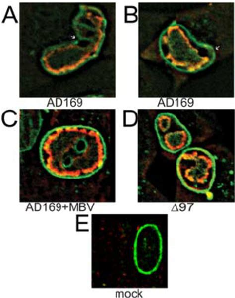 Confocal Microscopy Of Ul Dependent Nuclear Lamina Alterations In