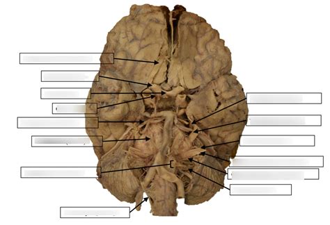 Cadaver Cranial Nerves Diagram Quizlet