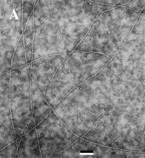 Electron Micrographs Of F Actin And Adff Actin Filam Open I