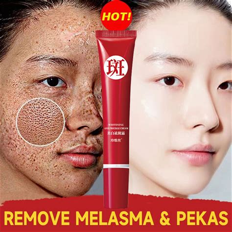 Jual Codpenghilang Flek Hitam Cream Penghilang Flek Hitam Di Wajah