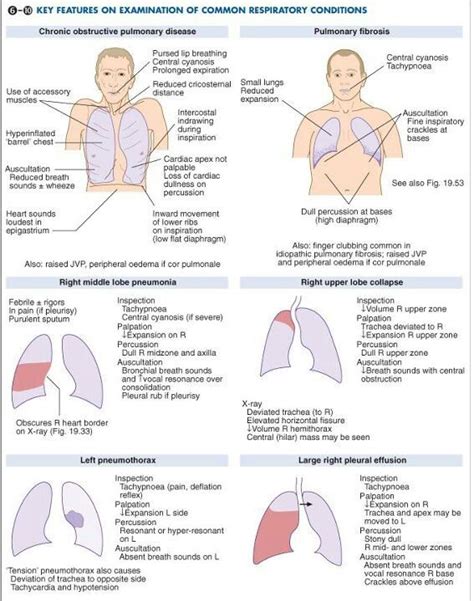 Auscultation Nurse Respiratory Nursing Mnemonics