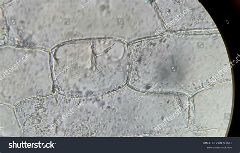 20 Leaf Cell Plasmolysis Images, Stock Photos & Vectors | Shutterstock