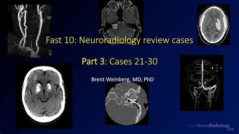 Fast 10 Neuroradiology High Speed Case Review Part 3 Cases 21 30