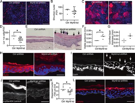 Myh9 Knockdown Disrupts Nuclear Degradation And Differentiation A Ctrl