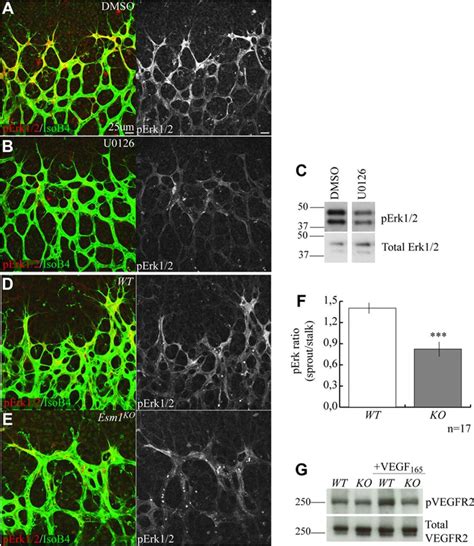 Esm Modulates Endothelial Tip Cell Behavior And Vascular Permeability