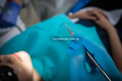 Удаление нерва зуба в Киеве | Блог | Стоматология Eurodental