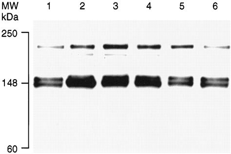 Homologous Up Regulation Of KDR Flk 1 Receptor Expression By Vascular