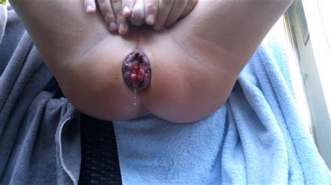 Ass Play Extreme Gay Gaping Gaping Porn XHamster