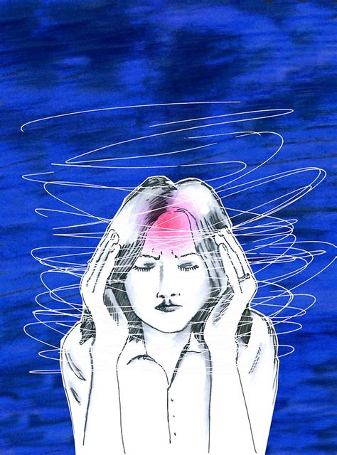 Vestibular Migraine The Most Common Cause Of Dizziness