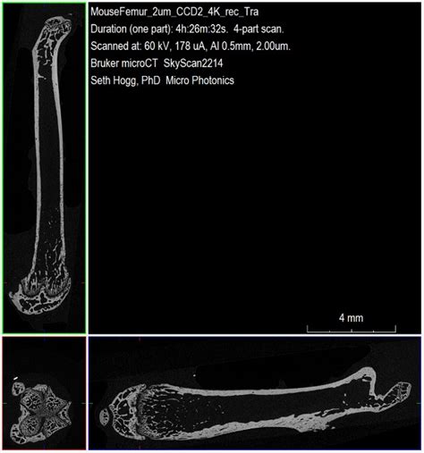 X Ray Microscopic Examination Of Murine Femora Micro Photonics