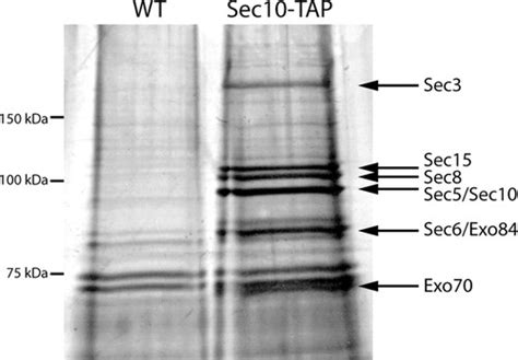 Rtn P Is Involved In Structuring The Cortical Endoplasmic Reticulum