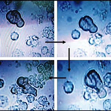 Entamoeba Histolytica Trophozoite In Wet Drop Preparation Showing Download Scientific Diagram