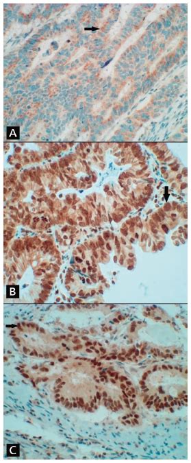 Scielo Brasil Are Stem Cell Marker Expression And Cd133 Analysis