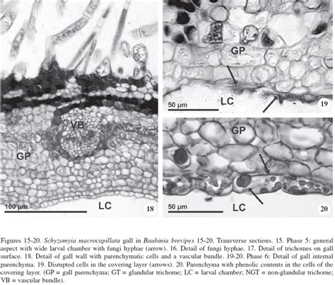 Scielo Brasil Anatomical And Developmental Aspects Of Leaf Galls