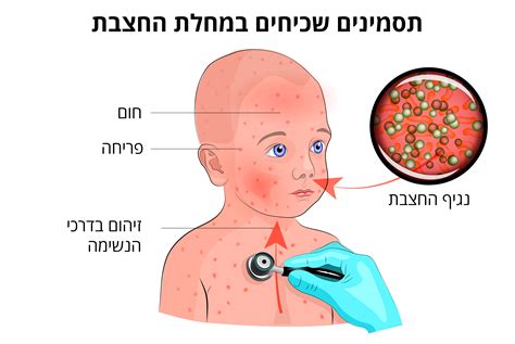 Макуло-Папулезная Сыпь - Картинки рисунки