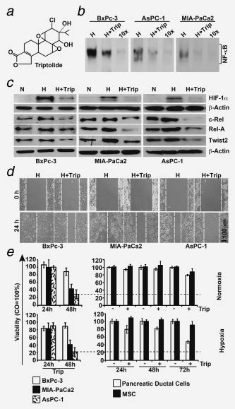 Triptolide Inhibits Hypoxia Induced Nf B And Migration A The