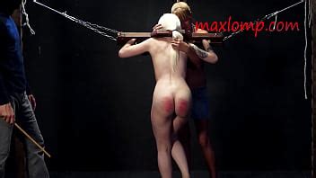 Hot Bruises On White Flesh XNXX