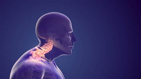 Forward Head Posture Neurosurgery And Spine Consultants