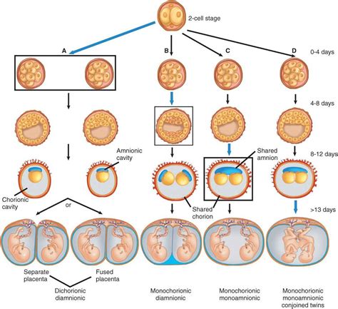 What Is Twin Zygosity Understanding Different Types Of