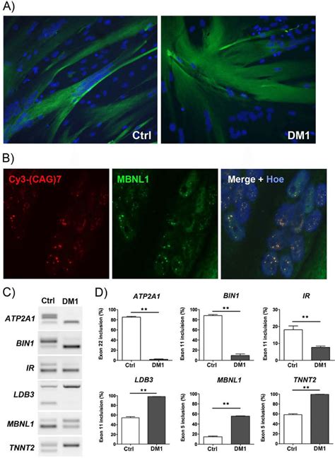 Characterization Of Dm1 And Ctrl Myotube Cultures Derived From