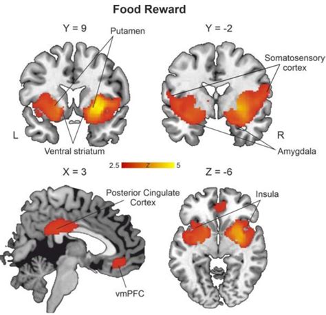 Ventral Striatum Fmri