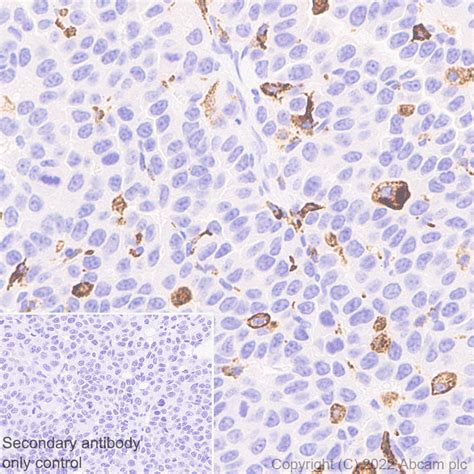 Anti Mannose Receptor Antibody Epr25215 277 Bsa And Azide Free