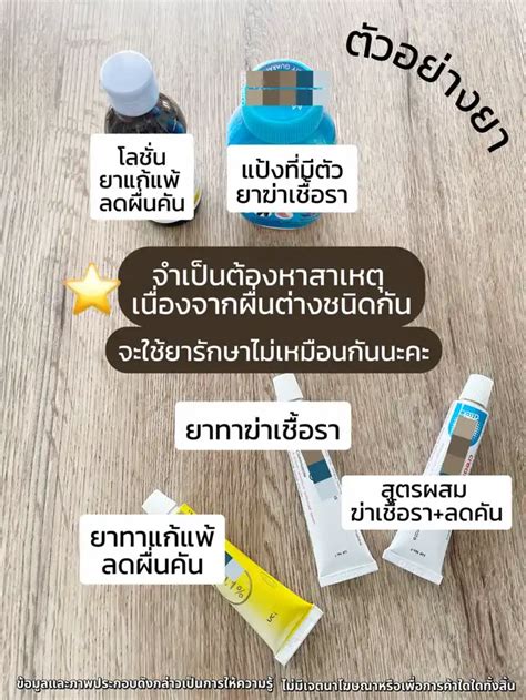 ยาแก้แพ้กินแล้วง่วงนอน Vs ไม่ง่วงนอน 😴 แกลเลอรีที่โพสต์โดย Teammii💊