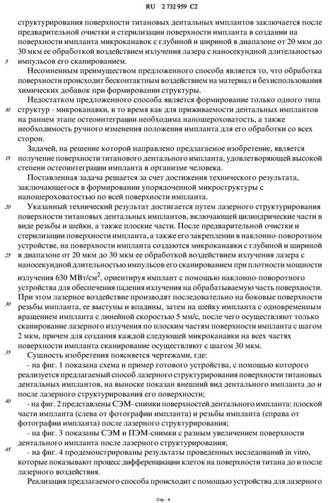 Официальный сайт Lenmiriot | Имплантационная система