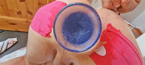 Closeup Fuck With Cm Wide Anal Plug Nude Pics Xhamster