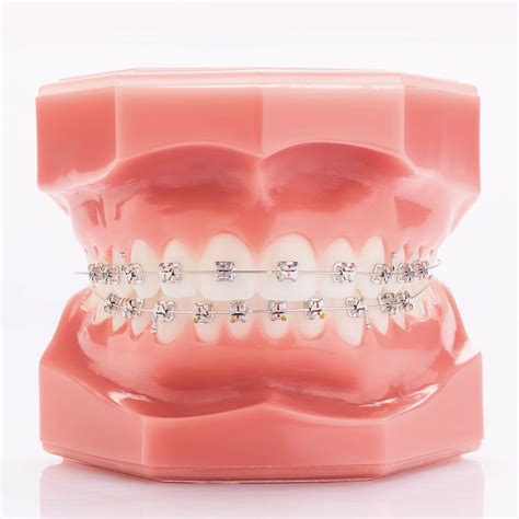 Legend Mini Rhodium Roth Mandibular Gc Orthodontics Inc