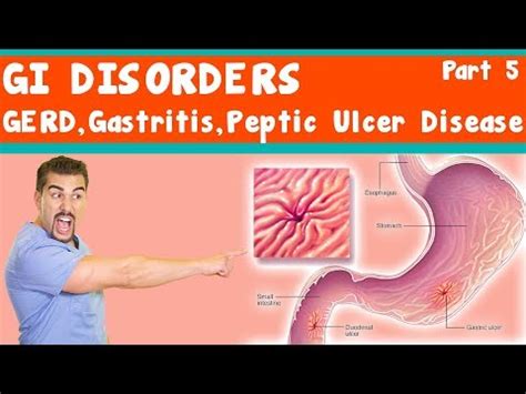 Gastritis vs. GERD vs. Peptic Ulcer *Part 5* - YouTube