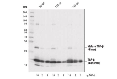 TGF β Antibody Cell Signaling Technology