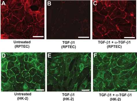 Zo Protein Expression In Anti Tgf Antibody Treated Primary And