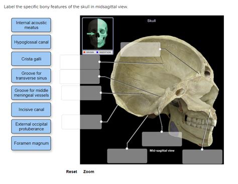 Solved Label The Specific Bony Features Of The Skull In