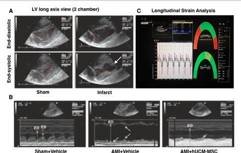 Figure From Human Umbilical Cord Matrix Mesenchymal Cells Improved