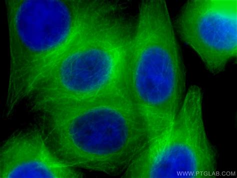 Beta Tubulin Antibody Cl488 66240 Proteintech