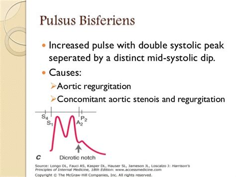 Pulse- Abnormal Findings