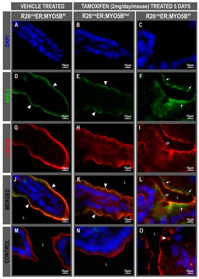 JCM | Special Issue : Microvillus Inclusion Disease and Related ...