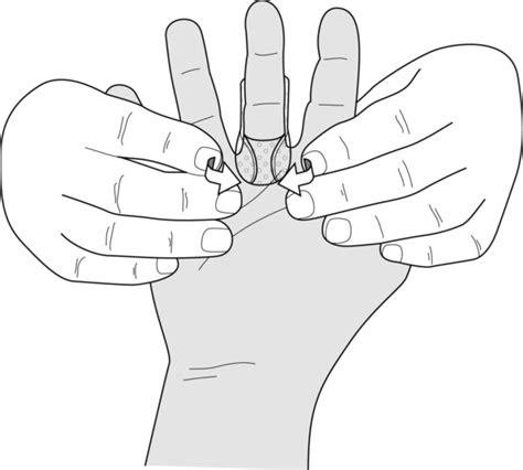 Guide PIP extension splints