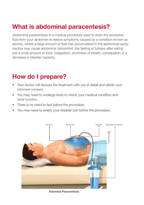 What Is Abdominal Paracentesis Slideshare